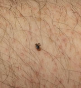Poor example of a tick photo