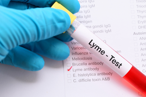 Lyme blood test
