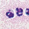 Microscopic image of Anaplasma phagocytophilum