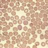 Microscopic image of Babesia microti