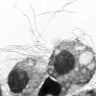 Microscopic image of Borrelia lonestari