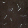Microscopic image of Borrelia mayonii