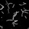 Microscopic image of Borrelia miyamotoi