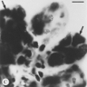 Microscopic image of Powassan virus Lineage II